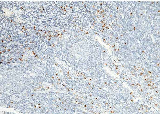 Anti-Human GZMB Antibody [B245] - ABMIUM