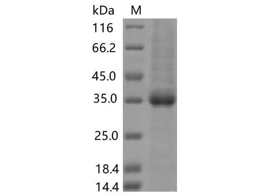 > 85 % as determined by reducing SDS-PAGE.