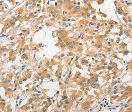 Anti-Human/Mouse/Rat APC5 Antibody