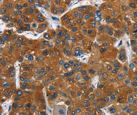 Anti-Human CATSPER3 Antibody