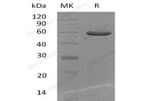 Recombinant Mouse CPQ/PGCP Protein (His Tag) - ABMIUM