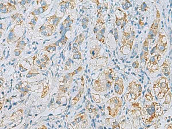 Anti-Human/Mouse/Rat PLA2G15 Antibody