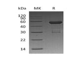 Recombinant Human OTUB2 Protein (GST Tag) - ABMIUM