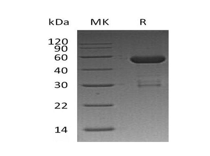 Recombinant Human OTUB2 Protein (GST Tag) - ABMIUM