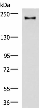 Western blot analysis of Mouse brain tissue lysate using KIF21B Polyclonal Antibody at dilution of 1:1000