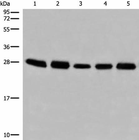 Western blot analysis of 293T cell lysates using GATD3B Polyclonal Antibody at dilution of 1:250
