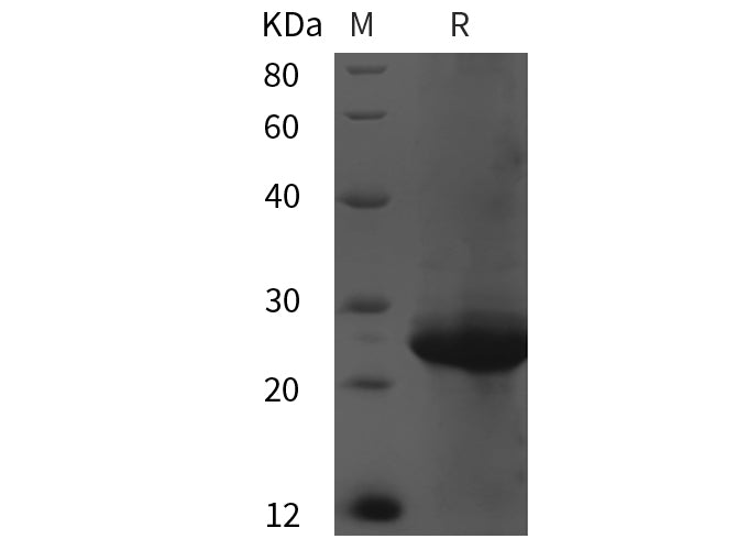SDS-PAGE analysis of Human FGFR1OP2 proteins, 2 μg/lane of Recombinant Human FGFR1OP2 proteins was resolved with SDS-PAGE under reducing conditions, showing bands at 25 kDa.