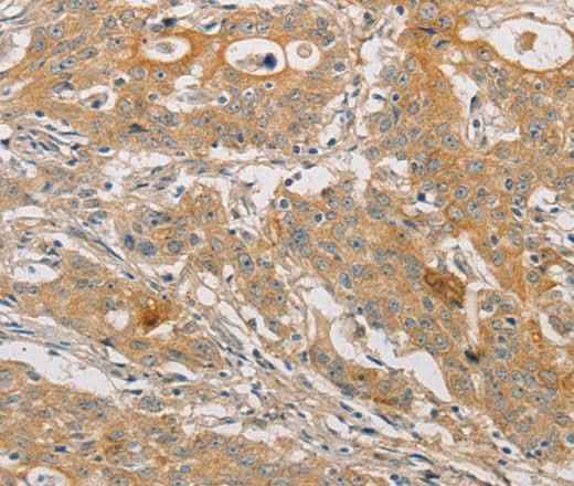 Anti-Human/Mouse/Rat ARSK Antibody