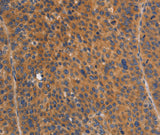 Anti-Human/Mouse NOD1 Antibody - ABMIUM