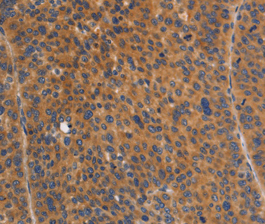 Anti-Human/Mouse NOD1 Antibody - ABMIUM