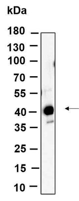 Anti-Human/Mouse/Rat FBX32 Antibody [B879]