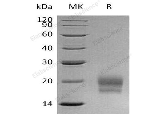 Recombinant Human CEACAM3/CD66d Protein (His Tag) - ABMIUM