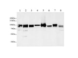 Anti-Human/Mouse/Rat CANX Antibody - ABMIUM