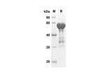SDS-PAGE analysis of Human ACE2 proteins, 2 μg/lane of Recombinant Human ACE2 proteins was resolved with SDS-PAGE under reducing conditions, showing bands at 58.2 kDa.