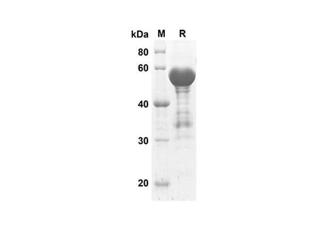 SDS-PAGE analysis of Human ACE2 proteins, 2 μg/lane of Recombinant Human ACE2 proteins was resolved with SDS-PAGE under reducing conditions, showing bands at 58.2 kDa.