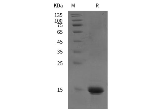 SDS-PAGE analysis of Human IL22 proteins, 2 μg/lane of Recombinant Human IL22 proteins was resolved with SDS-PAGE under reducing conditions, showing bands at 15 kDa.