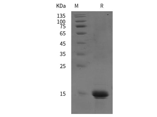 SDS-PAGE analysis of Human IL22 proteins, 2 μg/lane of Recombinant Human IL22 proteins was resolved with SDS-PAGE under reducing conditions, showing bands at 15 kDa.