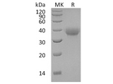 Recombinant Human OX40/TNFRSF4 Protein (His Tag) - ABMIUM
