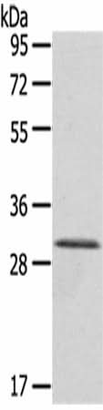 Anti-Human/Mouse HTATIP2 Antibody - ABMIUM