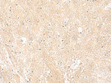 Immunohistochemistry of paraffin-embedded Human brain tissue using EMC1 Polyclonal Antibody at dilution of 1:35(×200)