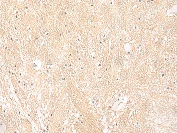 Immunohistochemistry of paraffin-embedded Human brain tissue using EMC1 Polyclonal Antibody at dilution of 1:35(×200)