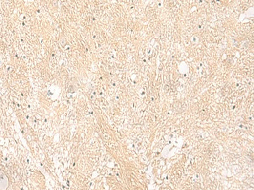 Immunohistochemistry of paraffin-embedded Human brain tissue using EMC1 Polyclonal Antibody at dilution of 1:35(×200)