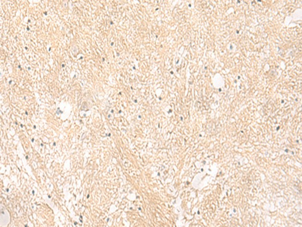 Immunohistochemistry of paraffin-embedded Human brain tissue using EMC1 Polyclonal Antibody at dilution of 1:35(×200)
