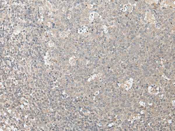 Anti-Human/Mouse ZFYVE1 Antibody