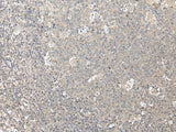 Immunohistochemistry of paraffin-embedded Human tonsil tissue using ZFYVE1 Polyclonal Antibody at dilution of 1:40(×200)