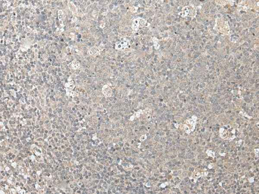 Anti-Human/Mouse ZFYVE1 Antibody