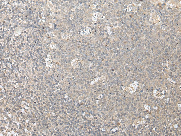 Immunohistochemistry of paraffin-embedded Human tonsil tissue using ZFYVE1 Polyclonal Antibody at dilution of 1:40(×200)
