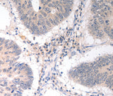 Anti-Human CD275 Antibody - ABMIUM
