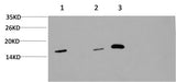Western Blot analysis of 1) Hela, 2) 3T3, 3) Rat brain using MAP1LC3A Monoclonal Antibody at dilution of 1:1000.