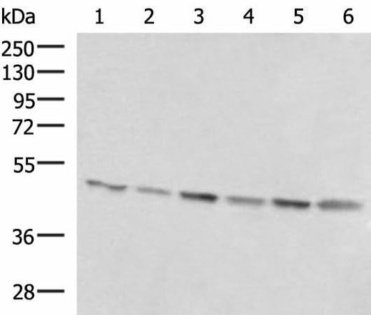 Western blot analysis of 293T K562 and HepG2 cell lysates using RHAG Polyclonal Antibody at dilution of 1:1600