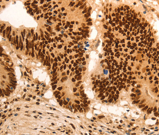 Anti-Human E2F7 Antibody - ABMIUM