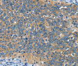 Anti-Human/Mouse DTX1 Antibody - ABMIUM