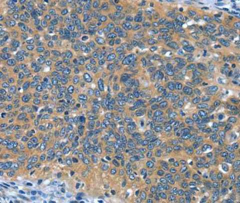 Anti-Human/Mouse DTX1 Antibody