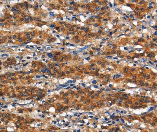 Anti-Human/Mouse/Rat ANPEP Antibody