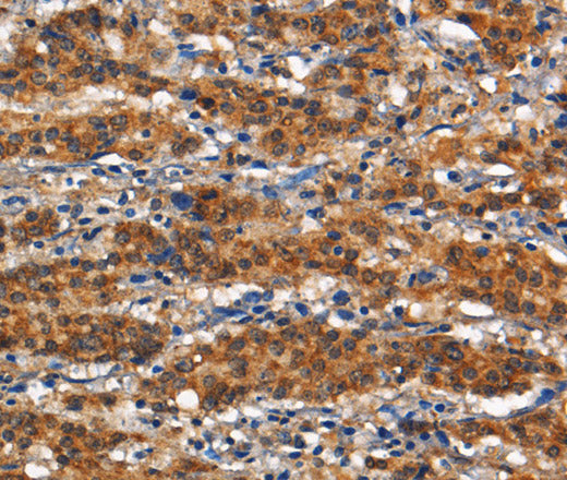 Anti-Human/Mouse/Rat ANPEP Antibody - ABMIUM
