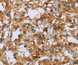 Anti-Human/Mouse/Rat NRN1 Antibody - ABMIUM
