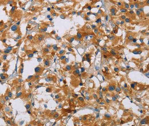 Anti-Human/Mouse/Rat NRN1 Antibody