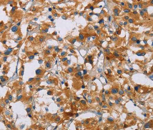 Anti-Human/Mouse/Rat NRN1 Antibody