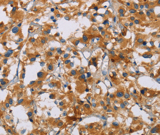 Anti-Human/Mouse/Rat NRN1 Antibody - ABMIUM