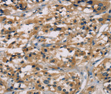 Anti-Human CGA Antibody - ABMIUM
