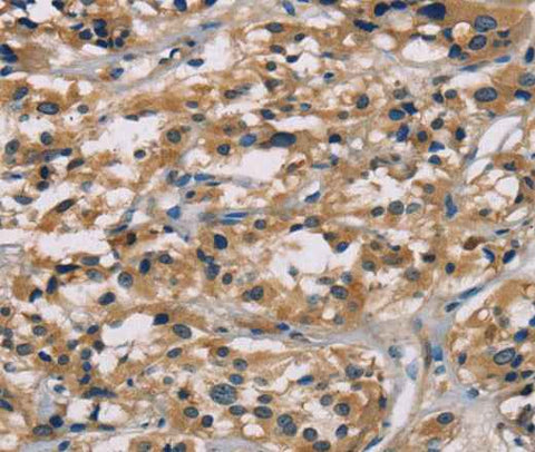 Anti-Human CGA Antibody