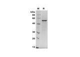 SDS-PAGE analysis of Human TIMP-2 proteins, 2 μg/lane of Recombinant Human TIMP-2 proteins was resolved with SDS-PAGE under reducing conditions, showing bands at 50 kDa.