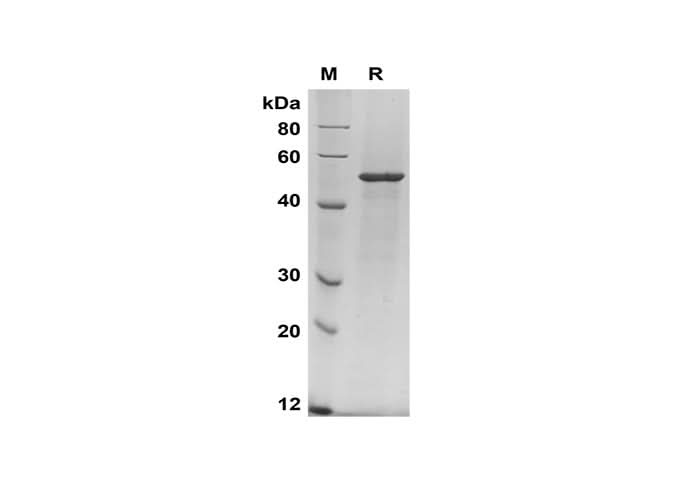SDS-PAGE analysis of Human TIMP-2 proteins, 2 μg/lane of Recombinant Human TIMP-2 proteins was resolved with SDS-PAGE under reducing conditions, showing bands at 50 kDa.