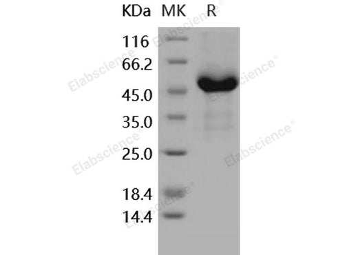 Recombinant Human GFRA3/GFR-alpha-3 Protein (His Tag) - ABMIUM