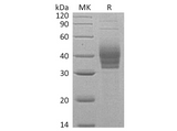 Recombinant Human Cerberus/CER1 Protein (His Tag) - ABMIUM
