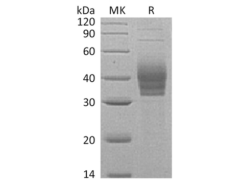 Recombinant Human Cerberus/CER1 Protein (His Tag) - ABMIUM